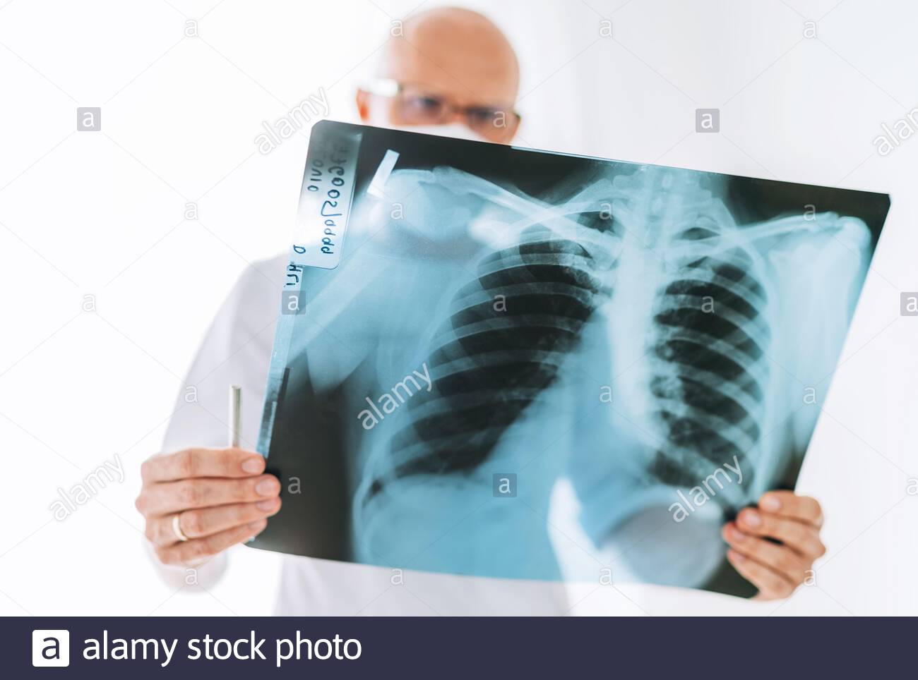 X-Ray (Digital)